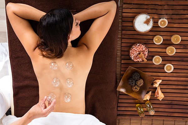 Cupping Treatment Vancouver and Burnaby