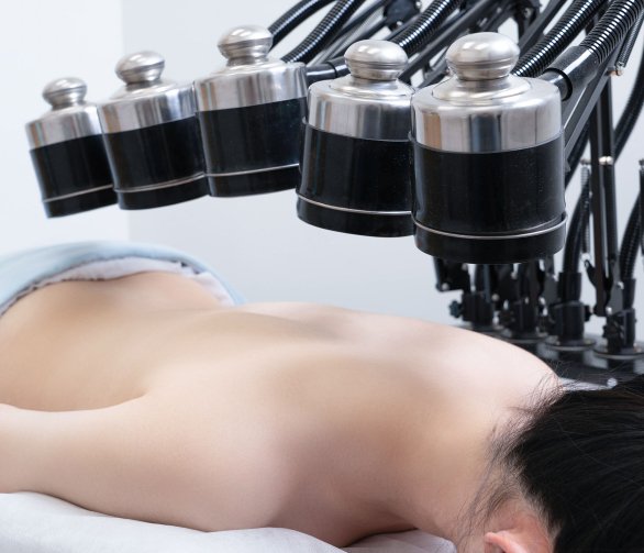 Moxibustion