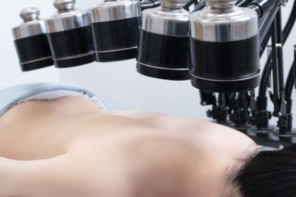 Moxibustion